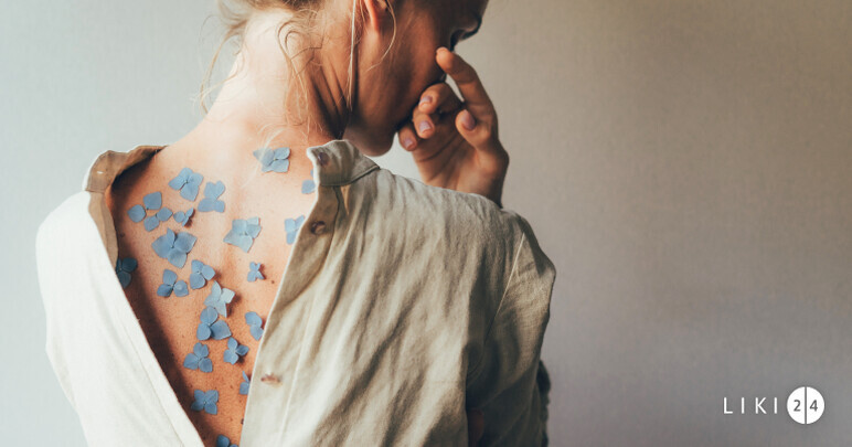 Psoriasis. Causes, symptoms, treatment