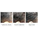 Kit against hair loss, Ageless Clinic, 3 pieces, Ru:t hair, 80 ml, Biocart Kit against hair loss, Ageless Clinic, 3 pieces, Ru:t hair, 80 ml, Biocart