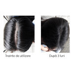 Kit against hair loss, Ageless Clinic, 3 pieces, Ru:t hair, 80 ml, Biocart Kit against hair loss, Ageless Clinic, 3 pieces, Ru:t hair, 80 ml, Biocart
