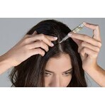 Complete treatment for early stages of hair loss and thinning hair in women Crescina Follicular Islands 1700, 10 + 10 ampoules, Labo Complete treatment for early stages of hair loss and thinning hair in women Crescina Follicular Islands 1700, 10 + 10 ampoules, Labo