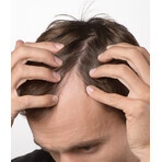 Complete treatment for early stages of hair loss and thinning hair in women Crescina Follicular Islands 1700, 10 + 10 ampoules, Labo Complete treatment for early stages of hair loss and thinning hair in women Crescina Follicular Islands 1700, 10 + 10 ampoules, Labo