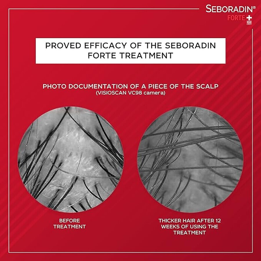 Treatment against hair loss Seboradin Forte, 14 vials x 5.5 ml, Lara