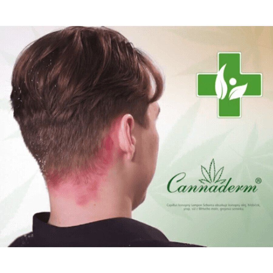 Cannaderm Capnaderm Capillus seborrhea shampoo 150 ml