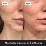 Hero Mighty Patch Invisible+ anti-acne patches x24 Hero Mighty Patch Invisible+ anti-acne patches x24