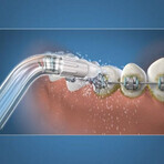 Orthodontic heads for mouthwash, 2 pieces, OD-100, Waterpik Orthodontic heads for mouthwash, 2 pieces, OD-100, Waterpik