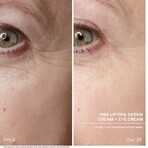 Babor HSR Lifting Anti-Wrinkle Serum 30ml Babor HSR Lifting Anti-Wrinkle Serum 30ml