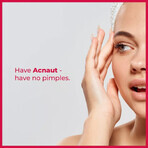 Crema idratante per pelli acneiche Acne Out Hydro Active, 60 ml, Biotrade Crema idratante per pelli acneiche Acne Out Hydro Active, 60 ml, Biotrade
